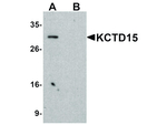 KCTD15 Antibody in Western Blot (WB)