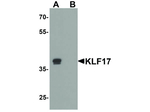 KLF17 Polyclonal Antibody