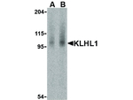 KLHL1 Polyclonal Antibody
