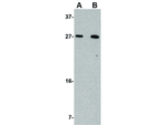 KLRA1 Antibody in Western Blot (WB)