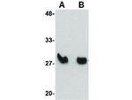 KLRA2 Antibody in Western Blot (WB)