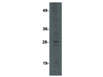 KLRA3 Polyclonal Antibody