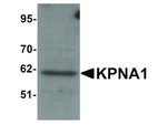KPNA1 Antibody in Western Blot (WB)