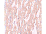 KPNA2 Antibody in Immunohistochemistry (Paraffin) (IHC (P))