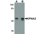 KPNA2 Antibody in Western Blot (WB)