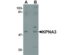 KPNA3 Antibody in Western Blot (WB)