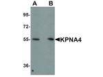 KPNA4 Antibody in Western Blot (WB)