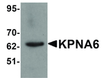KPNA6 Antibody in Western Blot (WB)