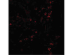 LAMP1 Polyclonal Antibody