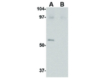 LASS5 Antibody in Western Blot (WB)