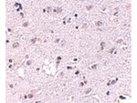 LASS5 Antibody in Immunohistochemistry (Paraffin) (IHC (P))
