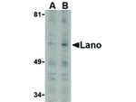 LASS5 Antibody in Western Blot (WB)
