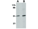 LASS5 Antibody in Western Blot (WB)