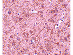 LASS6 Antibody in Immunohistochemistry (Paraffin) (IHC (P))