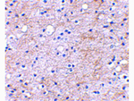 LGI1 Antibody in Immunohistochemistry (Paraffin) (IHC (P))