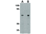 LGI2 Polyclonal Antibody