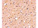 LGI2 Antibody in Immunohistochemistry (Paraffin) (IHC (P))