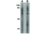 LGI2 Antibody in Western Blot (WB)