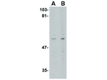 LGI4 Polyclonal Antibody