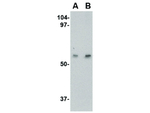 LGI4 Polyclonal Antibody