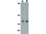 LGP2 Polyclonal Antibody
