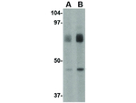LGP2 Polyclonal Antibody
