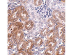 LIAR Antibody in Immunohistochemistry (Paraffin) (IHC (P))