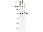 LIF Antibody in Western Blot (WB)