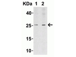 LIF Antibody in Western Blot (WB)
