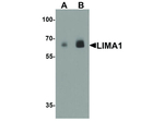 LIMA1 Polyclonal Antibody