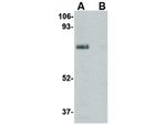 LIMP2 Antibody in Western Blot (WB)
