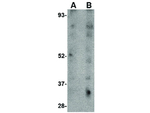 LIMP2 Antibody in Western Blot (WB)