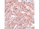 LIN28 Antibody in Immunohistochemistry (Paraffin) (IHC (P))