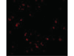 LIS1 Antibody in Immunocytochemistry (ICC/IF)