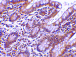 Livin Antibody in Immunohistochemistry (Paraffin) (IHC (P))