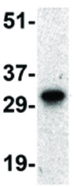 Livin Antibody in Western Blot (WB)