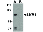 LKB1 Polyclonal Antibody