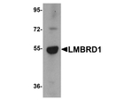 LMBRD1 Antibody in Western Blot (WB)