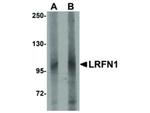 LRFN1 Antibody in Western Blot (WB)
