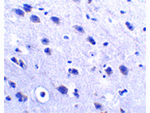 LRFN2 Antibody in Immunohistochemistry (Paraffin) (IHC (P))