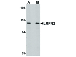 LRFN2 Antibody in Western Blot (WB)