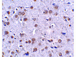 LRFN4 Antibody in Immunohistochemistry (Paraffin) (IHC (P))