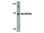 LRFN4 Antibody in Western Blot (WB)