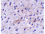 LRFN5 Polyclonal Antibody