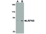 LRFN5 Antibody in Western Blot (WB)