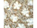 LRRFIP1 Antibody in Immunohistochemistry (Paraffin) (IHC (P))