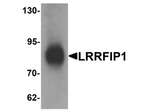LRRFIP1 Antibody in Western Blot (WB)