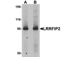 LRRFIP2 Antibody in Western Blot (WB)