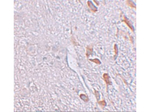 LRRTM1 Antibody in Immunohistochemistry (Paraffin) (IHC (P))