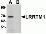 LRRTM1 Antibody in Western Blot (WB)